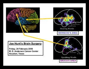 BrainWernickesBrocasAreas.pdf