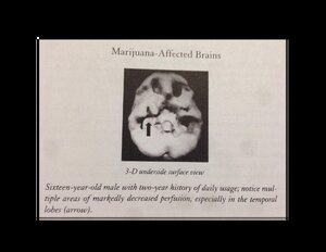 Marijuana-Affected-Brains.pdf