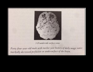 Marijuana-affected-Brains-Underside-View.pdf