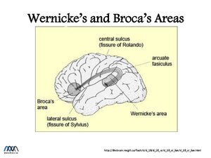 WernickesBrocasAreas.pdf